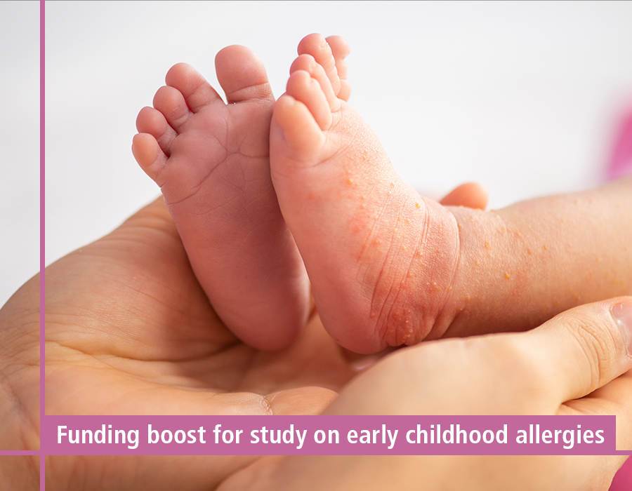 Funding boost for study on early childhood allergies