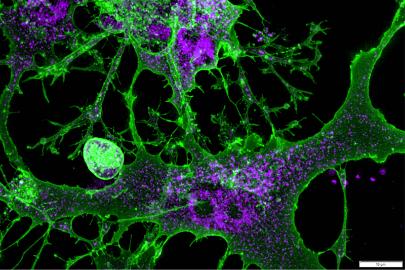 Wnts (purple) in intestinal telocytes (green)
