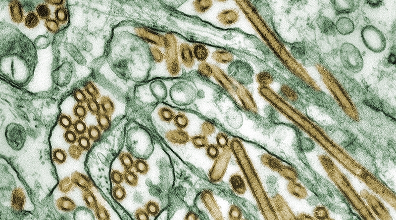 Digitally-colorized transmission electron microscopic image of Avian Influenza