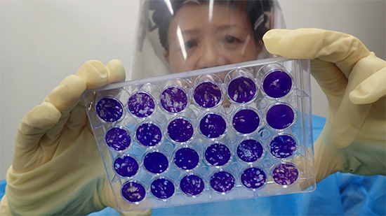 The result of the viral plaque assay is analysed.